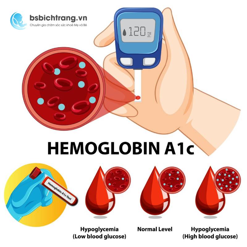 Tại sao phải xét nghiệm tiểu đường thai kỳ?