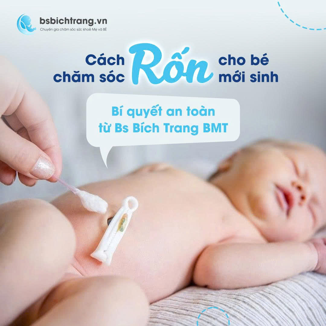 Cách chăm sóc rốn cho bé mới sinh: Bí quyết an toàn từ Bs Bích Trang BMT